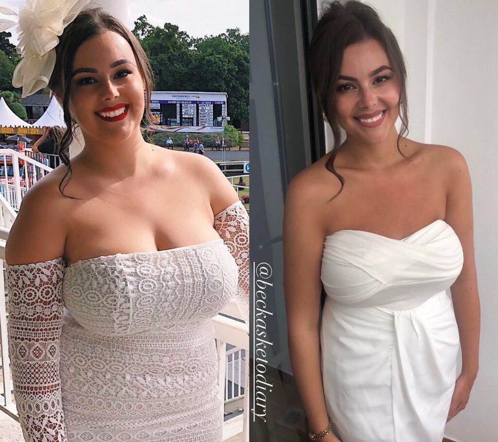 An image showing two girls, the same girl, but looking very different after dramatic weight loss. The image on the left is Becky when she was unhappy with her weight. The image on the right is Becky after losing five stone in weight. The purpose of the image is to show her incredible weight loss for her episode of The Secrets Of Weight Loss with Roberto podcast